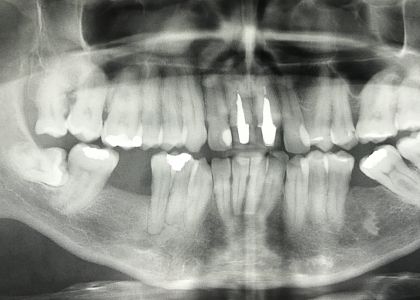 Ortodontia E Implantes 2